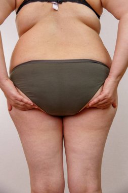 hormonal bozukluğu olan bir kadının portresi.geri