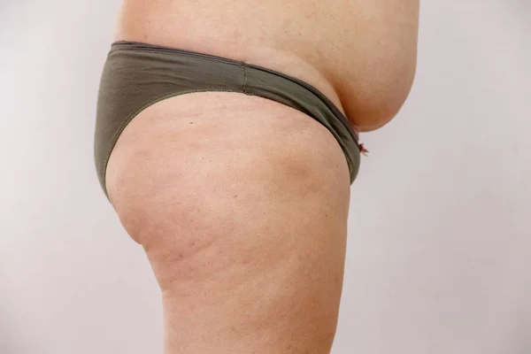 Fetma Kvinna Underkläder — Stockfoto