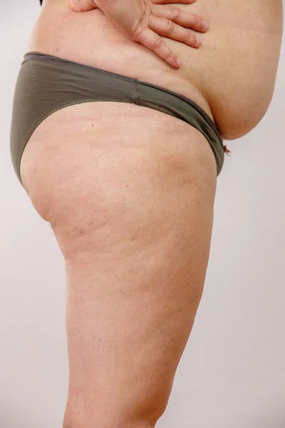 Ожирение Женщина Нижнем Белье — стоковое фото