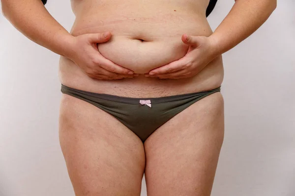 obesity woman in underwear