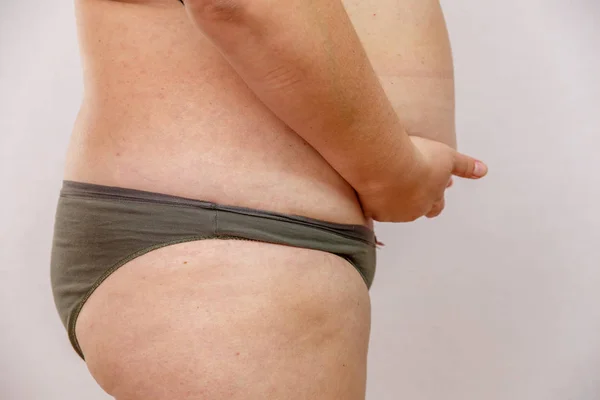 Çamaşırı Obezite Kadın — Stok fotoğraf