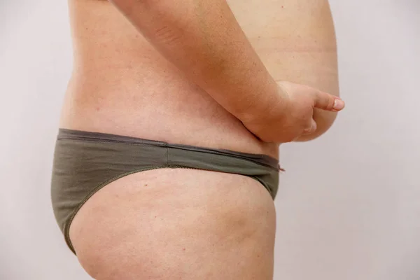 obesity woman in underwear