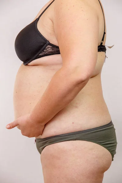 Παχυσαρκία Γυναίκα Εσώρουχα — Φωτογραφία Αρχείου