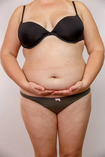 Fettleibige Frau Unterwäsche — Stockfoto