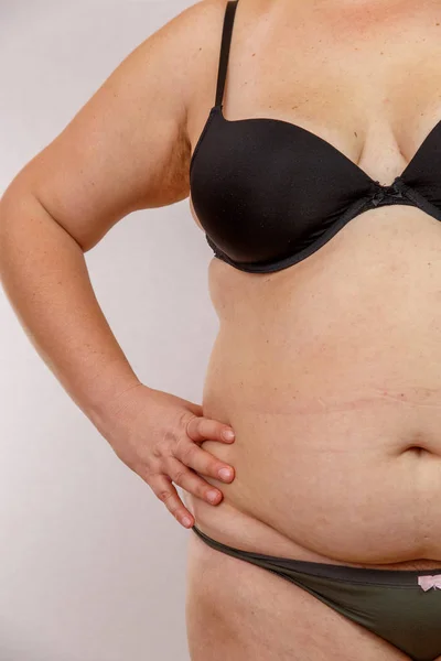 obesity woman in lingerie