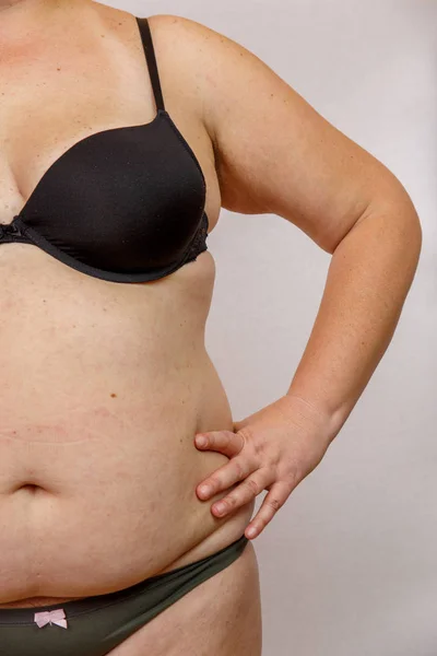 Ожирение Женщина Нижнем Белье — стоковое фото