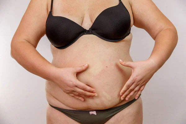 Mujer Aprieta Estómago Chica Aprieta Grasa Estómago Pliegues Grasos Abdomen — Foto de Stock