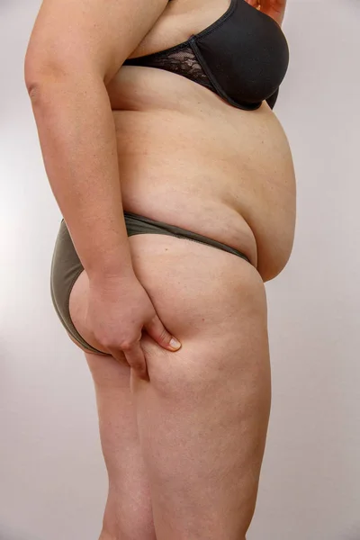 호르몬 장애를 여자의 초상화 Back — 스톡 사진