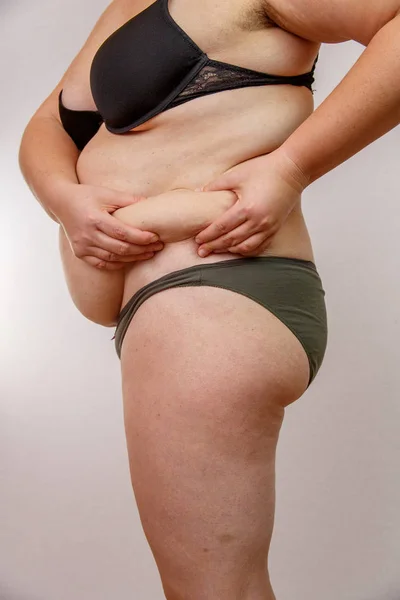 woman squeezes her stomach, girl squeezes fat on her stomach, fatty folds on the abdomen