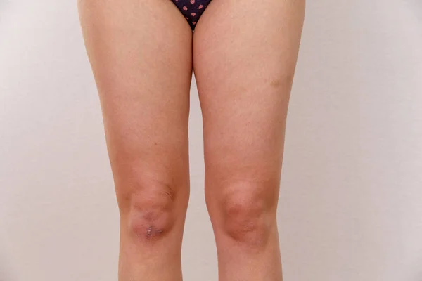 Woman Legs Overweight Underwear — 스톡 사진