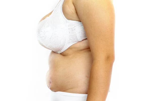 若いですオーバー加重女性でランジェリー上の白い隔離された背景 — ストック写真
