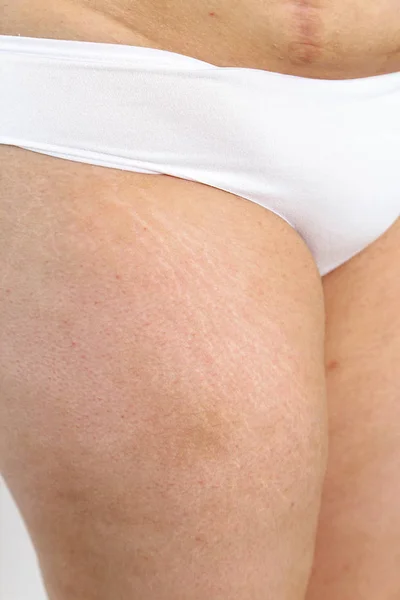 Giovane donna sovrappeso in lingerie su backgroun isolato bianco — Foto Stock