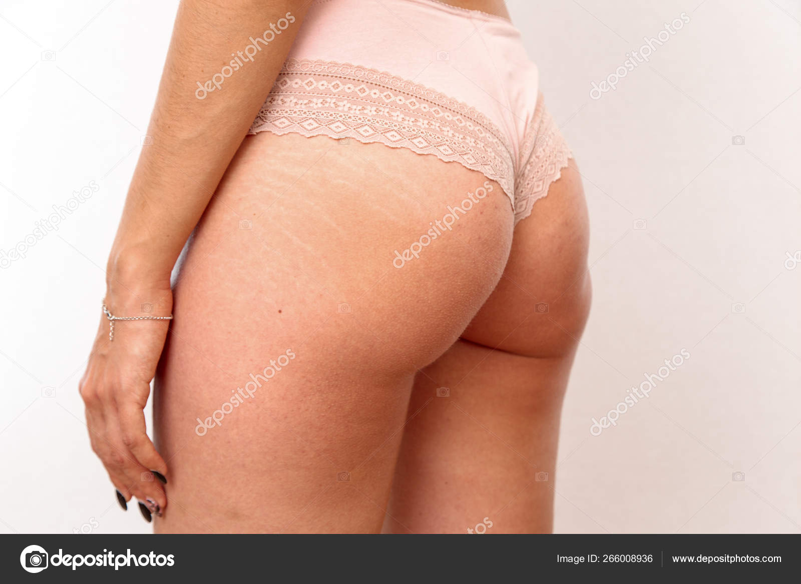 Stock photography ▻ Young woman shows her buttocks with cellulite and stret...