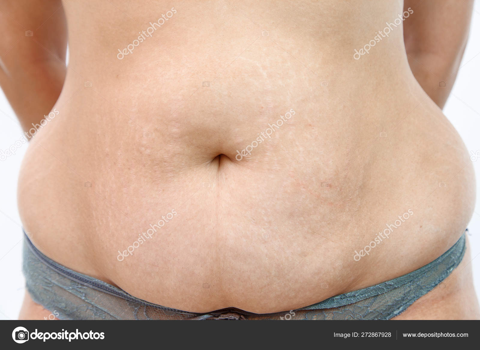 Стрессовый живот у женщин. Пастозность живота. Пастозность живота. Пастозность живота. Животик у мужчин с жирком.