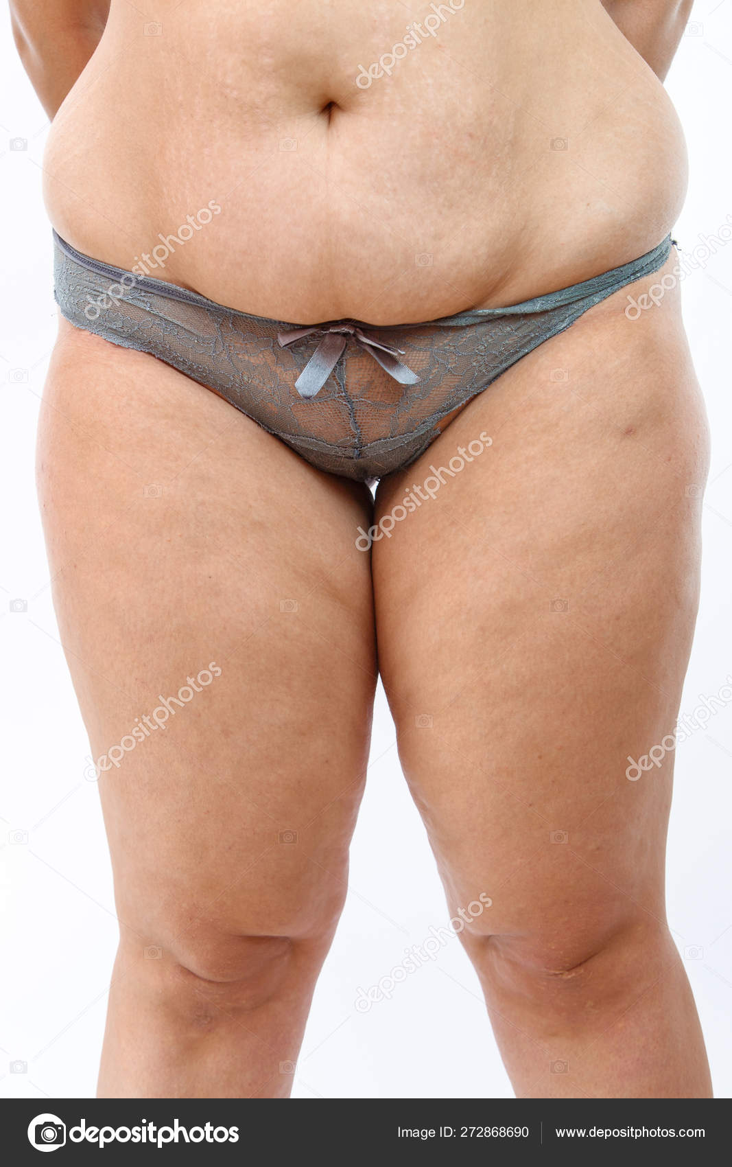 Big Belly And Cellulite Fat Legs Of Overweighted Woman Isolated