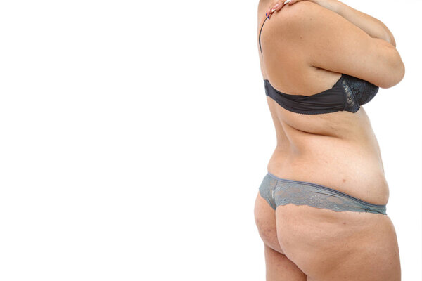 the body of a young woman in lingerie with stretch marks and ove