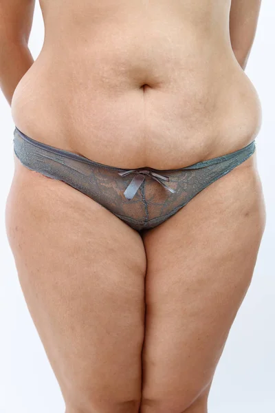 Pancia grande e cellulite gambe grasse della donna sovrappeso isolato — Foto Stock