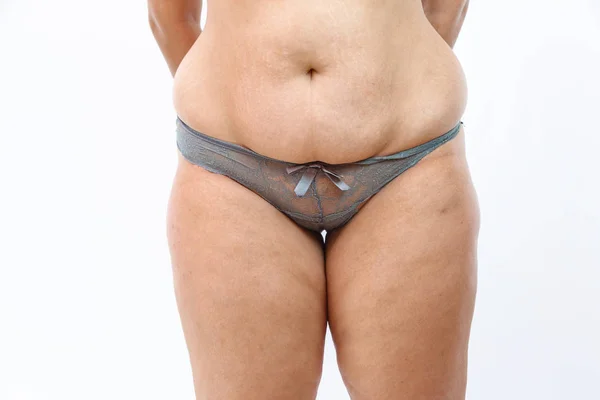 Barriga grande e celulite pernas gordas de mulher sobrecarregada isolado — Fotografia de Stock