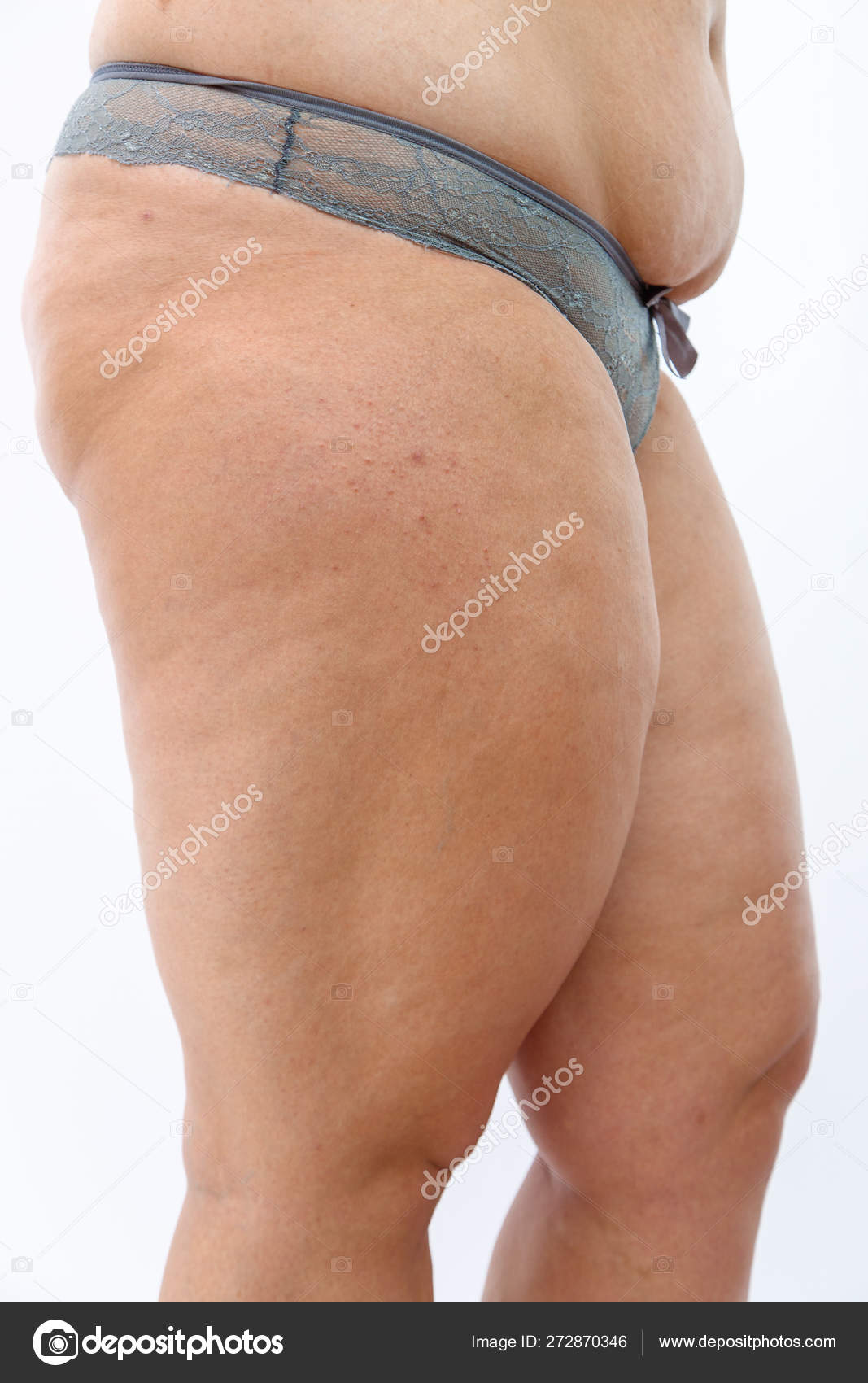 Big Belly And Cellulite Fat Legs Of Overweighted Woman Isolated