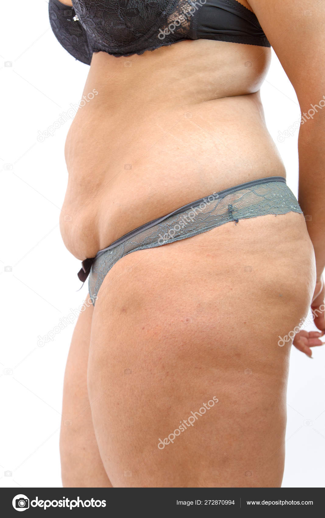 legs and belly of a 40-year-old woman with stretch marks, cellulite and  excess weight on a white isolated background Stock Photo - Alamy