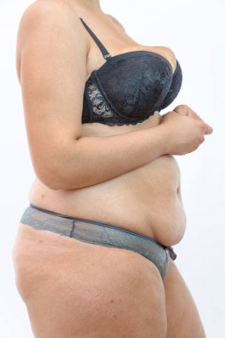 büyük göbek ve kilolu kadın izole selülit yağ bacaklar 