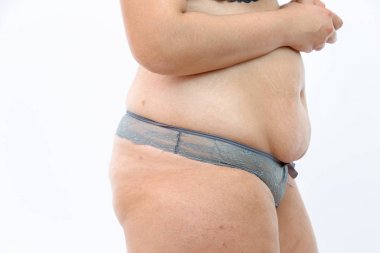 büyük göbek ve kilolu kadın izole selülit yağ bacaklar 