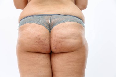 Genç, kilolu kadın iç çamaşırlarıyla, izole edilmiş beyaz bir grupta.