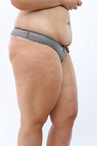 Dicker Bauch und Cellulite fette Beine der übergewichtigen Frau isoliert — Stockfoto