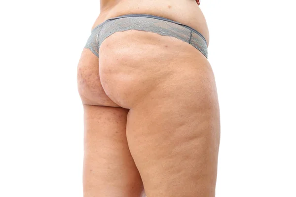 Jovem mulher com sobrepeso em lingerie no branco isolado backgroun — Fotografia de Stock