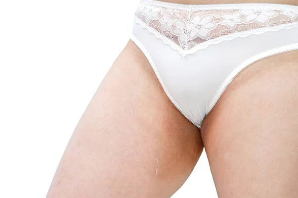 Woman in white underwear applying cream in the areas of rubbing — ストック写真