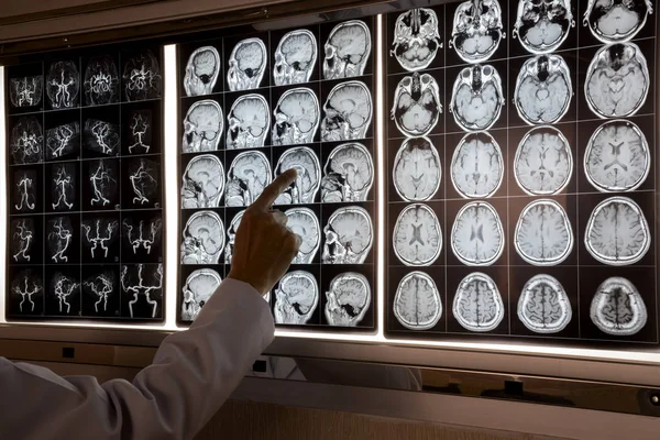 Doctor Apuntando Resonancia Magnética Del Cerebro Humano Caja Luz Para — Foto de Stock