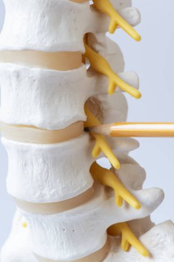 İnsan lomber intervertebral disk modeli anatomisi gösteren bir kalem yakından görmek 