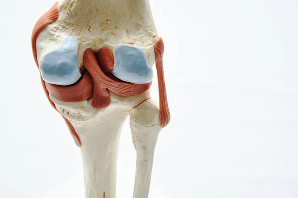医疗机构人工膝关节模型的特写图 — 图库照片