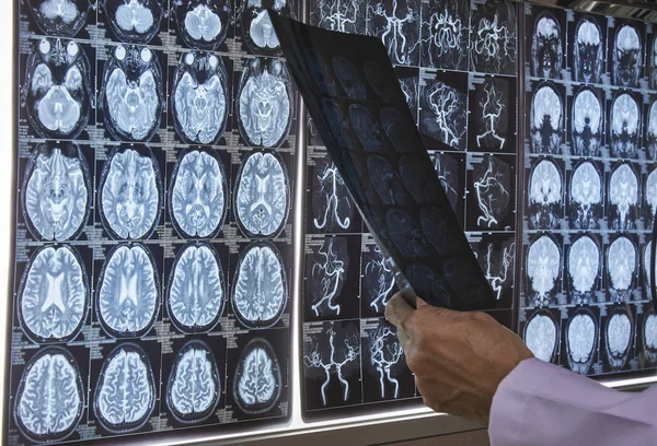 Doctor holding and reading a brain MRI film in medical office