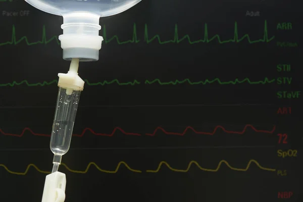 Внутривенная Физраствор Жидкость Пластиковой Бутылке Операционной Дисплей Мониторинга Заднем Плане — стоковое фото