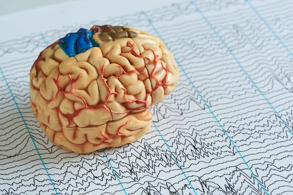 Искусственная Модель Человеческого Мозга Бумаге Фоне Ээг Волн — стоковое фото