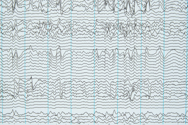 Изображение мозговых волн от электроэнцефалографии или ЭЭГ у человека

