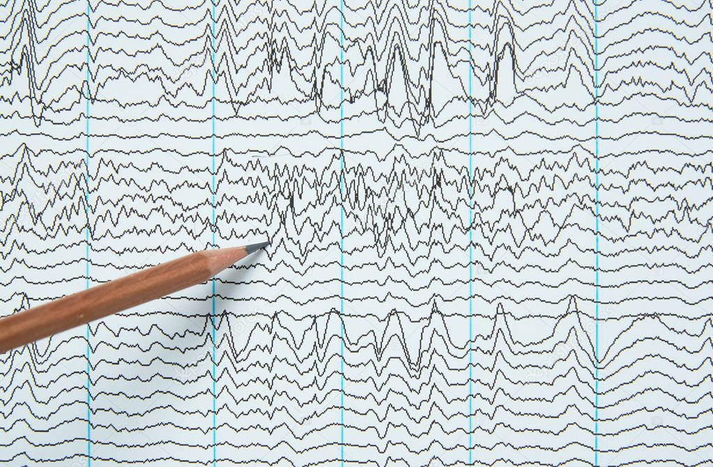 Pencil pointing at brain waves from electroencephalography or EEG in human