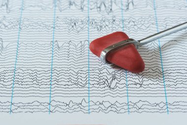 İnsan beyin dalgaları electroencephalogram üzerinden arka plan üzerinde refleks çekici