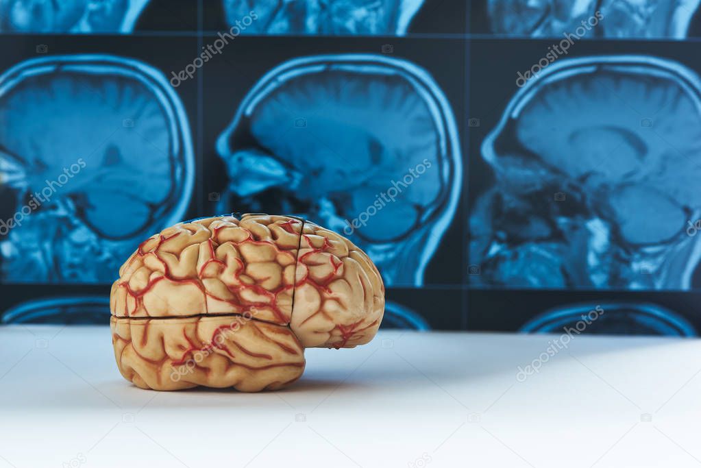 Human artificial brain model with side view of brain MRI imaging background