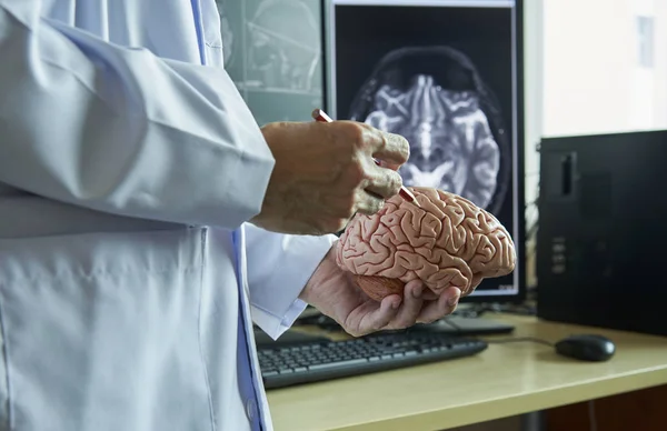 Modelo Cerebro Humano Mano Del Doctor Doctor Usando Lápiz Para — Foto de Stock