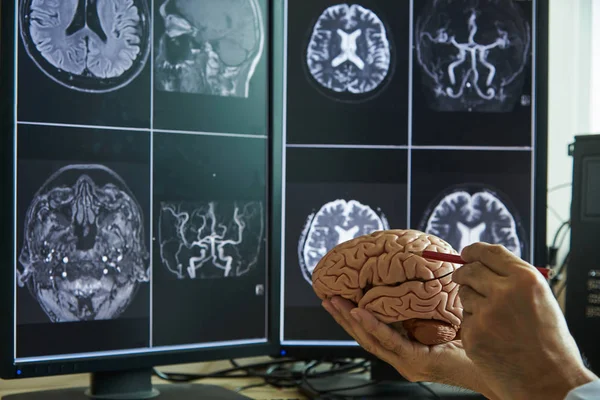 Modelo Cerebro Humano Mano Del Doctor Doctor Usando Lápiz Para — Foto de Stock