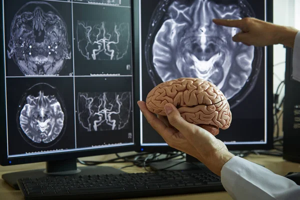 Modelo Cerebro Humano Mano Del Doctor Doctor Apuntando Cerebro Mri — Foto de Stock