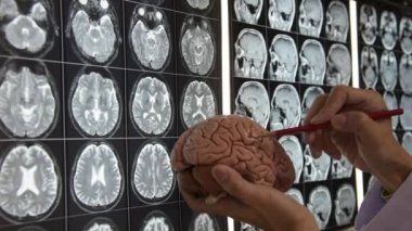 Doktor beyin modeli holding ve Mr görüntüleme beyin anatomi öğretim
