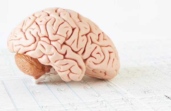 Model Lidského Mozku Pozadí Mozkových Vln Eeg — Stock fotografie