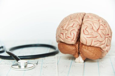 İnsan beyni modeli ve beyin dalgaları elektroansefalografi üzerinden arka plan üzerinde siyah bir stetoskop