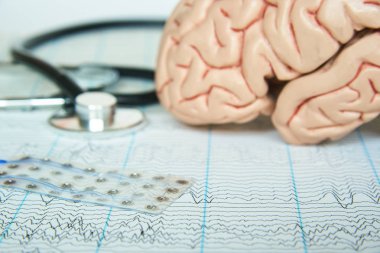 Subdural elektrot kılavuz electroencephalograpy kağıt üzerinde. İnsan beyni modeli ve arka plan üzerinde siyah bir stetoskop.