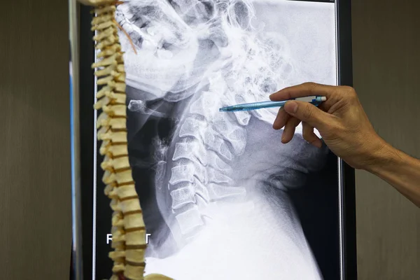 A neurosurgeon pointing at cervical spine x-ray imaging in medical office