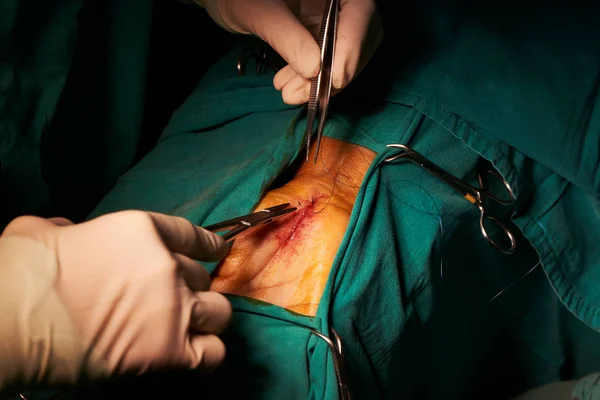 医師針ホルダーを押しながら手術室のステッチの縫合 — ストック写真