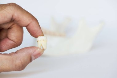 Ayıklanan bir yirmilik diş tutarak diş hekimi. İnsan Mandibula ve arka plan üzerinde diş 